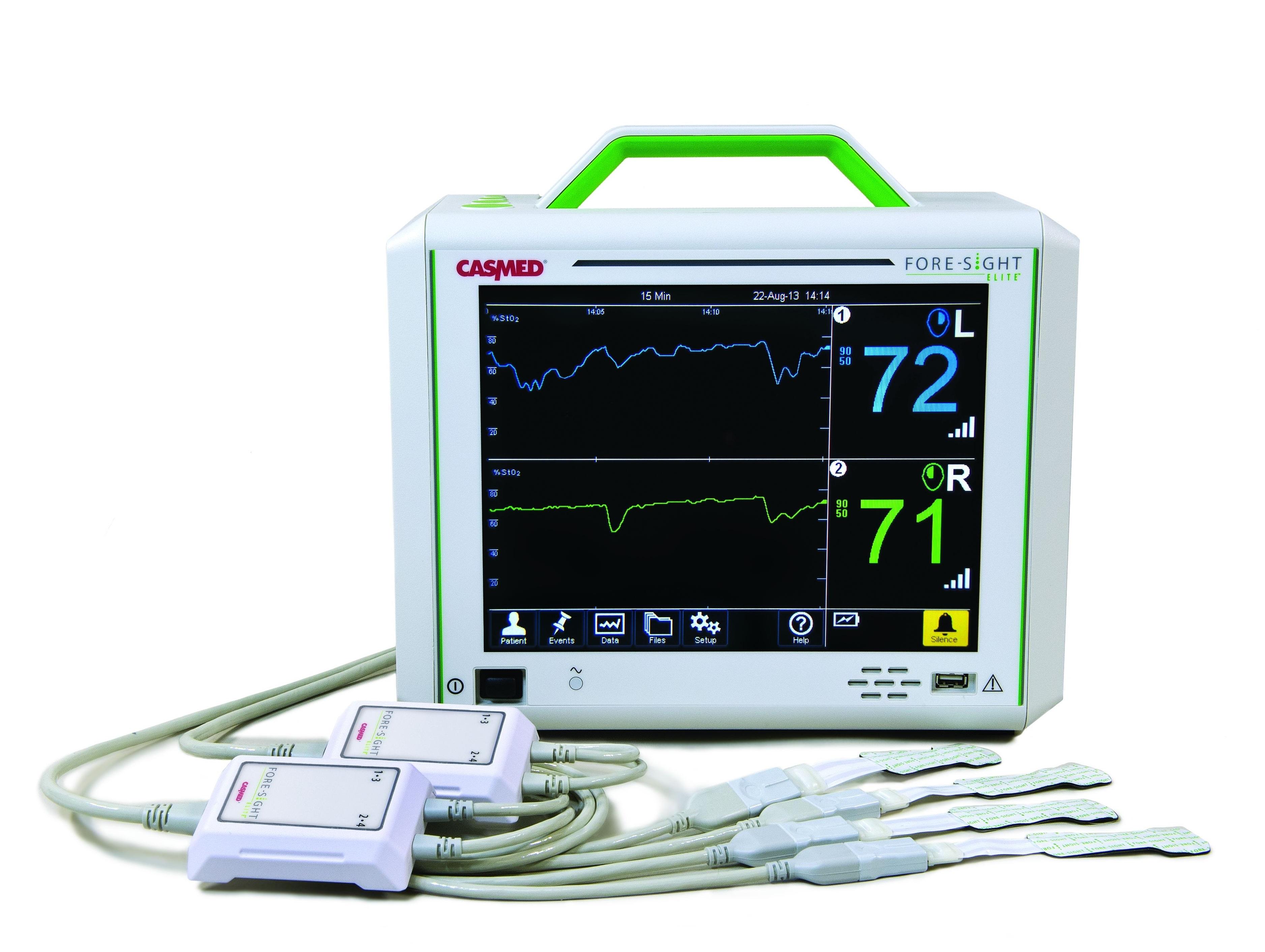 Монитор сатурации. Fore - Sight Elite оксиметр. Оксиметр церебральный оксиметр церебральный. Монитор аппарата ИВЛ.